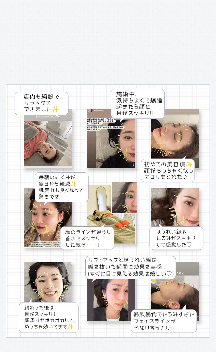 麻布十番で人気の美容鍼、Instagramの声